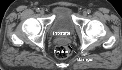 BARRIGEL IMAGES