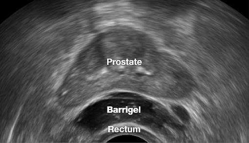 BARRIGEL IMAGES